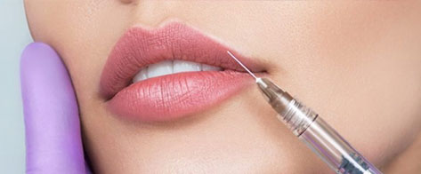 Proceso de aumento de labios con técnica rusa