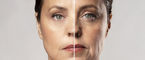 Tratamiento para combatir el envejecimiento facial