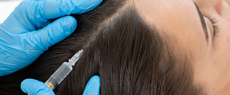 Paciente con tratamiento para alopecia y caída del cabello