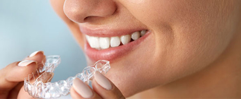 Paciente usando ortodoncia invisible Invisalign