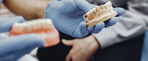 Prótesis dental adaptada a la dentadura