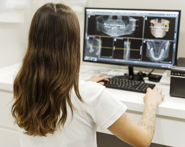 Proceso escáner 3D dental en Madrid