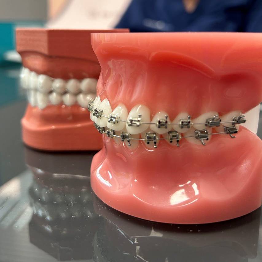Ortodoncia en Odontomedic