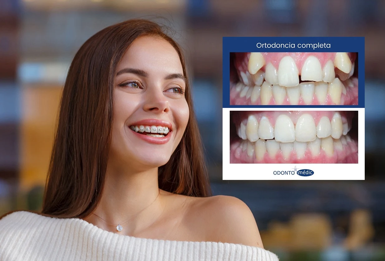 ortodoncia completa