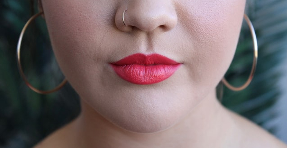 Aumento y perfilado de labios en Hortaleza con Odontomedic