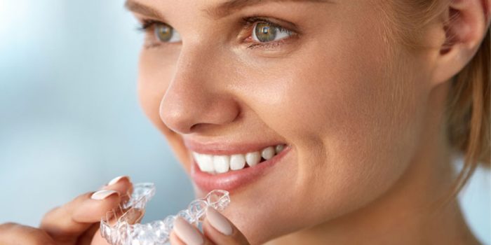 ¿Ortodoncia invisible o brackets? Ventajas y desventajas