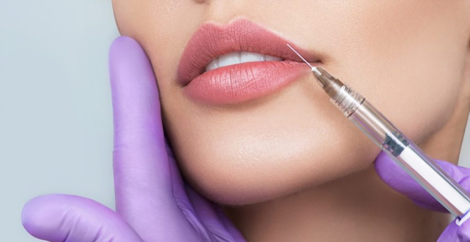 Russian Lips: la tendencia más buscada en relleno de labios